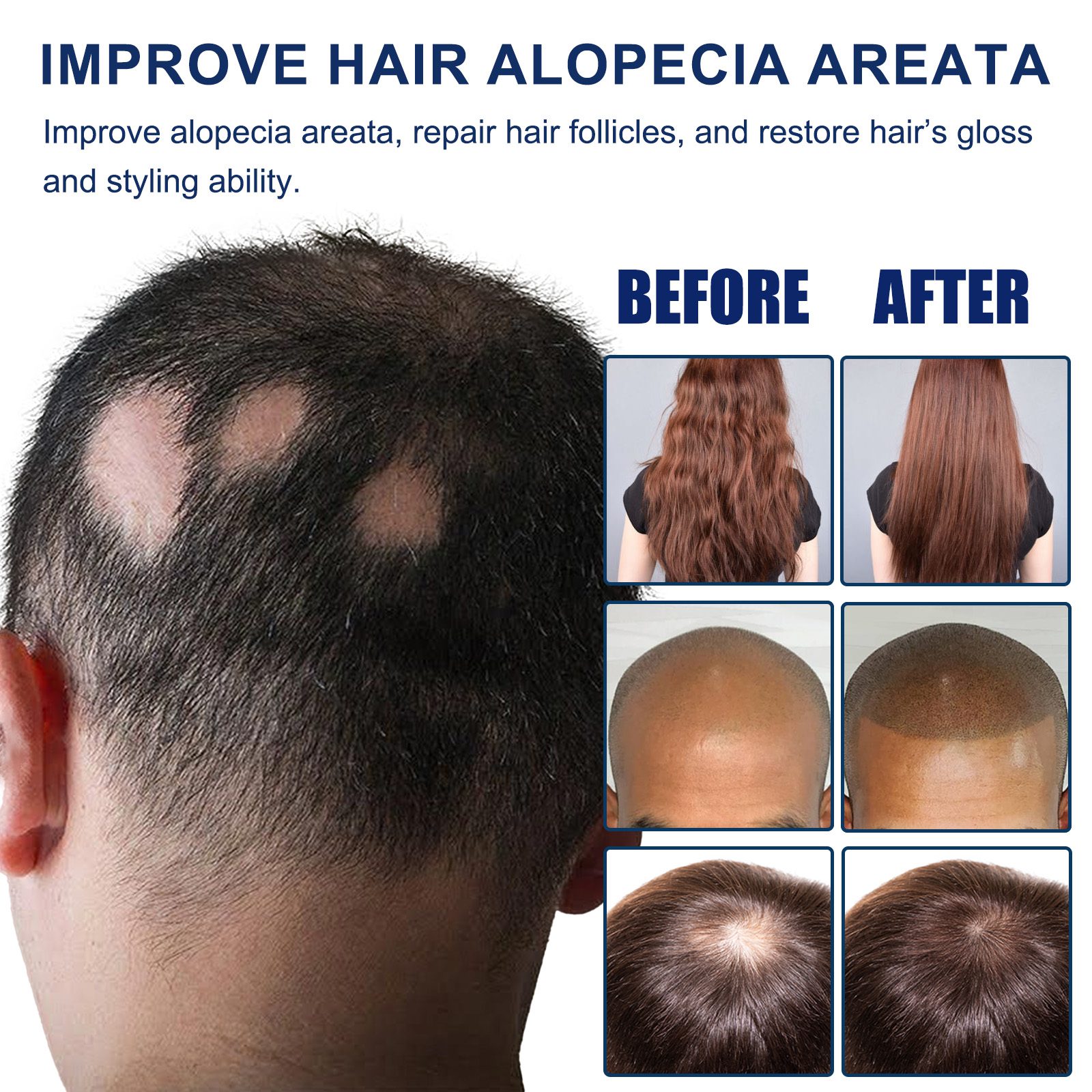 SOA03 A016 1 BU1 1730946607023