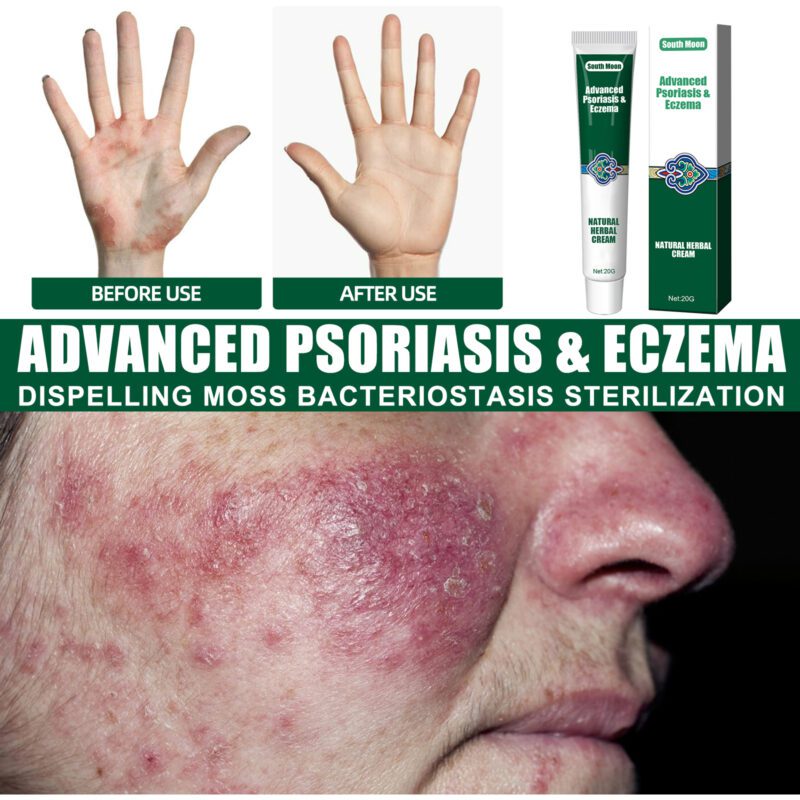 Gentle Herbal Cream - Daily Moisturizing & Hydrating Care for Soft, Soothed Skin - Image 2