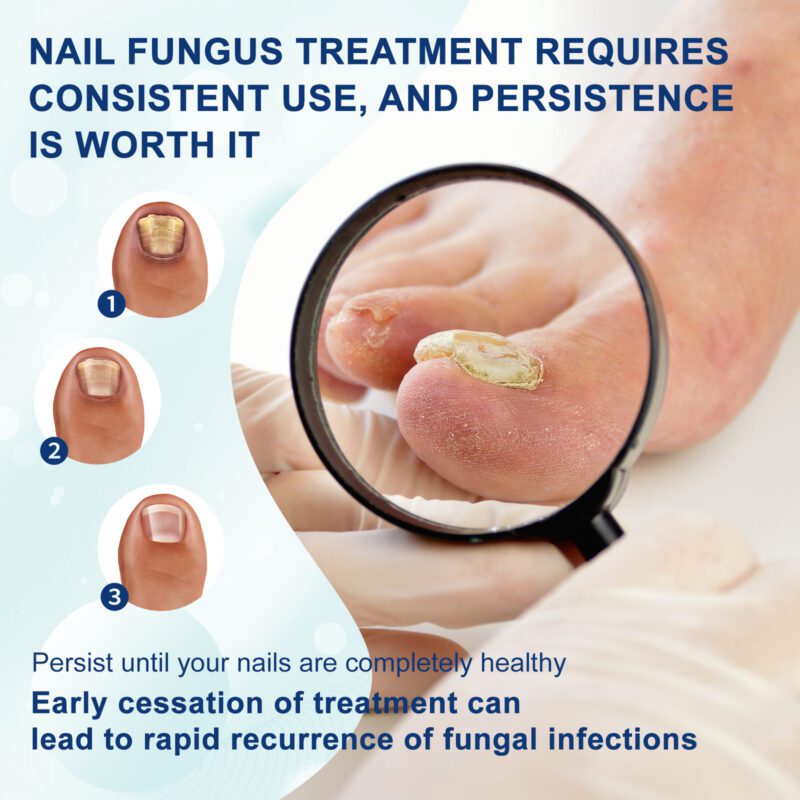 Natural Nail Care Pen with Tea Tree & Vitamin E for Soft Nails - Image 3