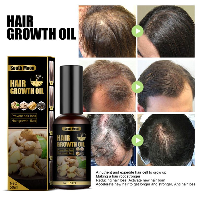 Natural Ginger Ginseng Scalp Care Spray - Daily Hair Nourishment & Shine - Image 4