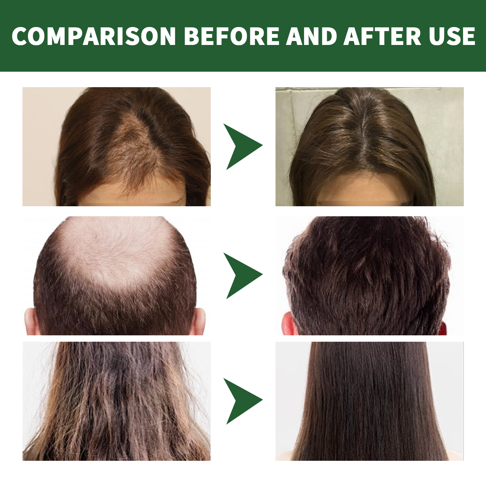 sfpw211yx01 100g 27782739