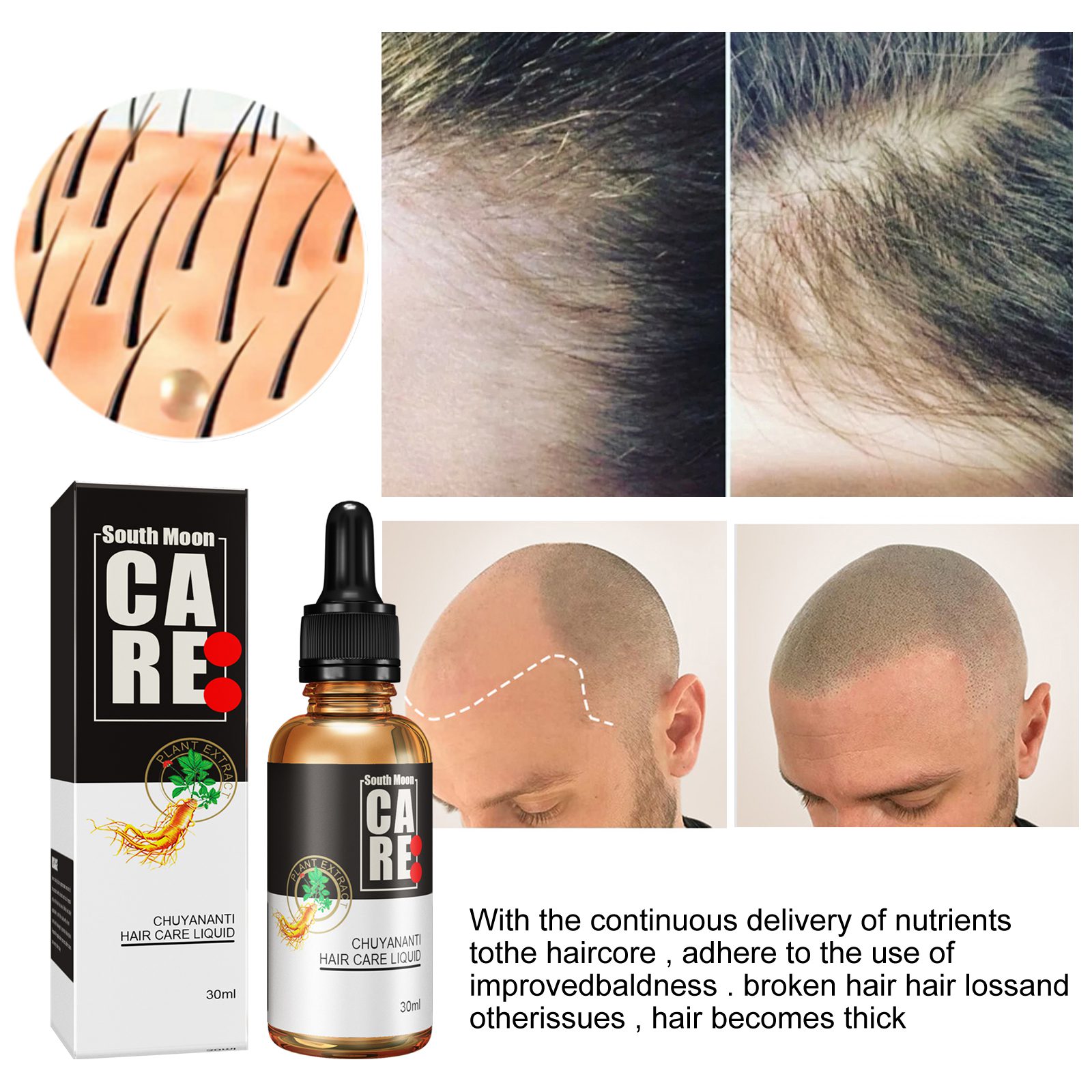 tfjh56yx01 30ml 004