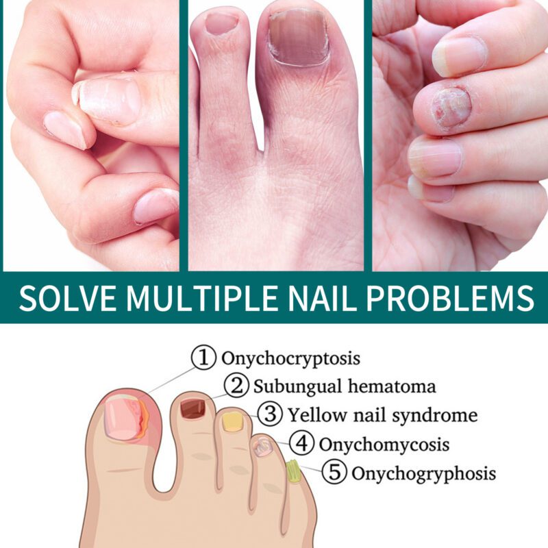 Gentle Nail Care Serum - Natural Plant Extracts for Shiny, Healthy Nails - Image 3