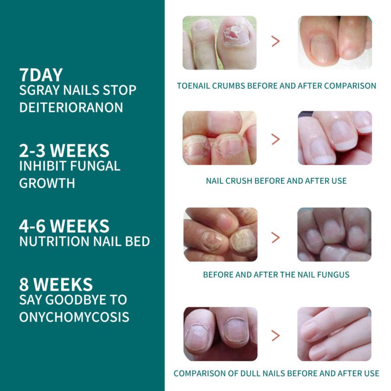 Gentle Nail Care Serum - Natural Plant Extracts for Shiny, Healthy Nails - Image 4