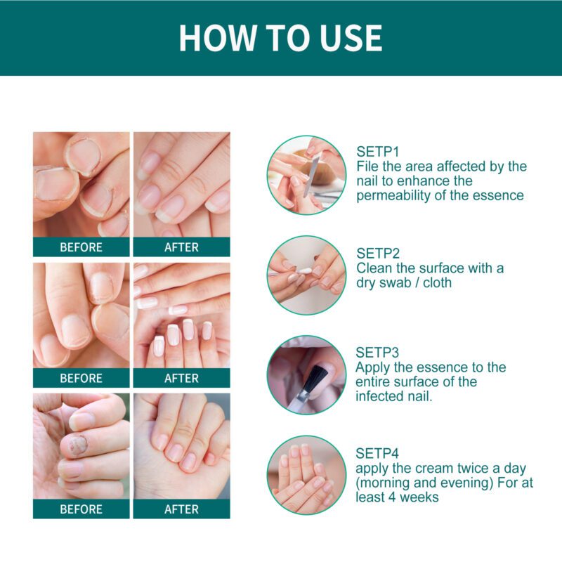 Gentle Nail Care Serum - Natural Plant Extracts for Shiny, Healthy Nails - Image 5