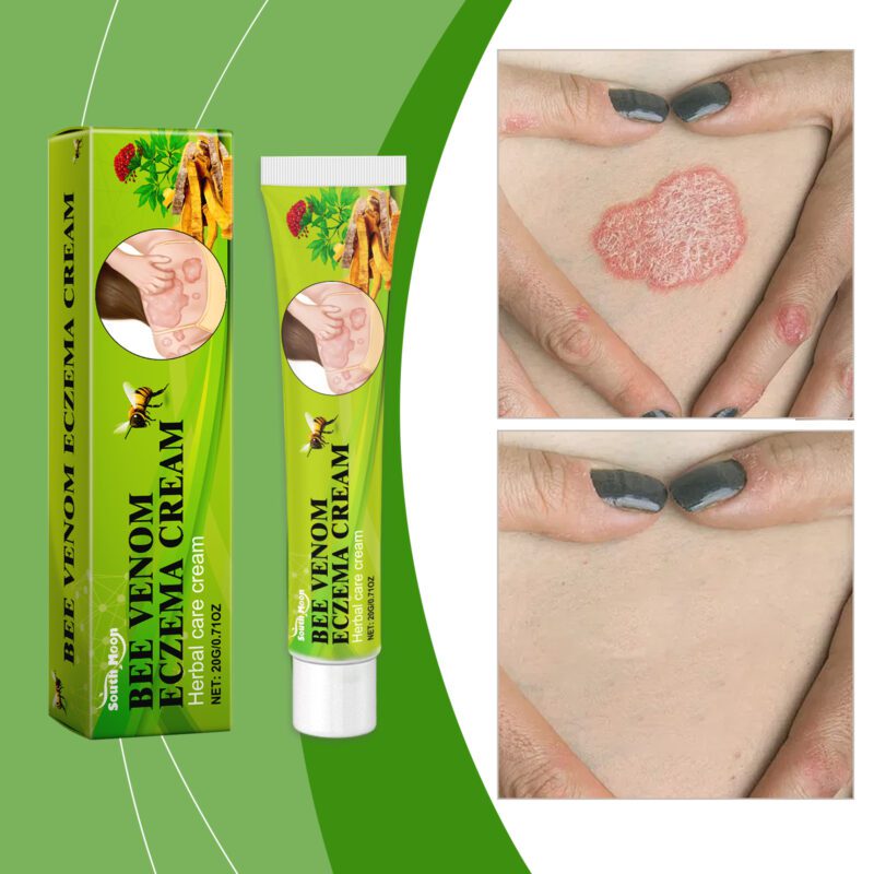 Natural Bee Venom Body Cream - Soft, Nourished Skin Moisturizer - Image 2