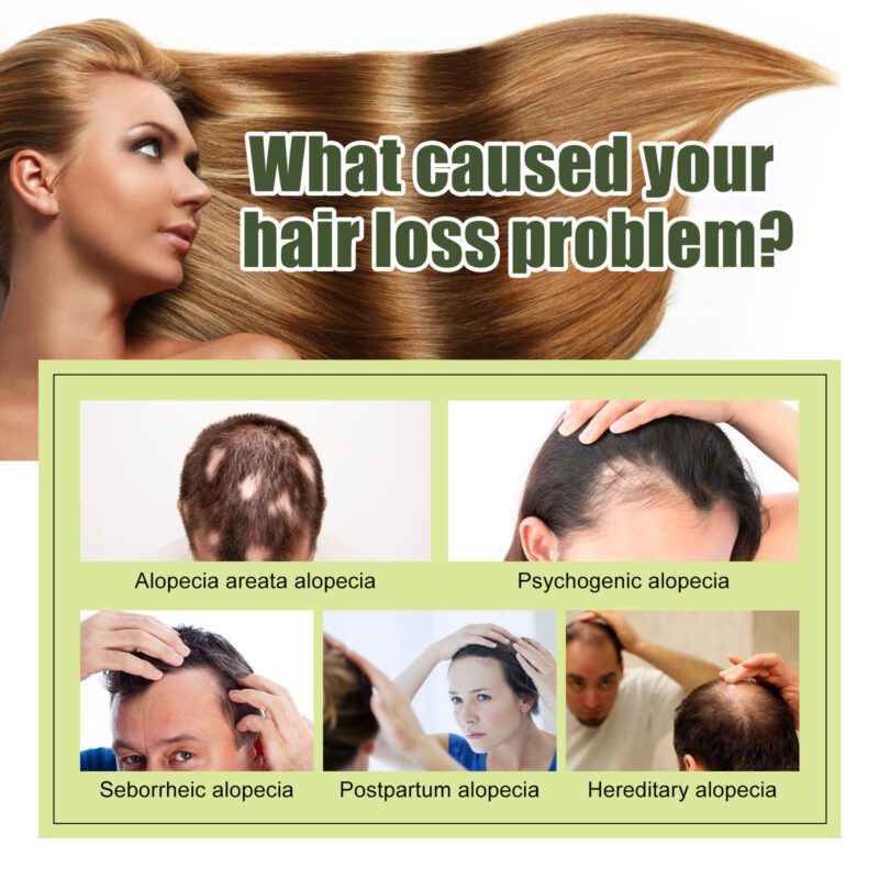 Gentle Hair Serum with Tea Tree & Nut Oil - Daily Care for Soft Shiny Hair - Image 4
